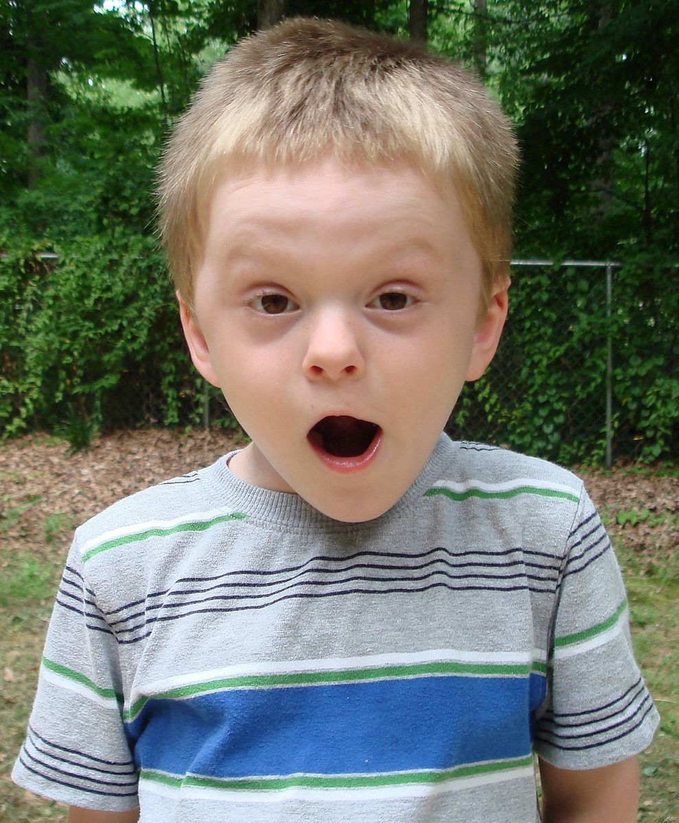 Surprised